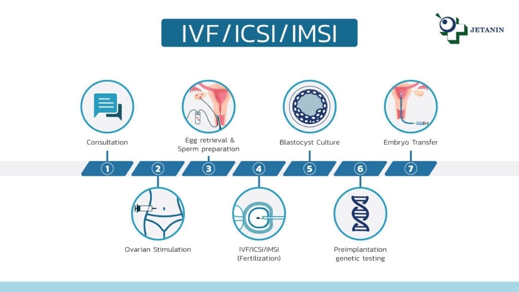 ivf