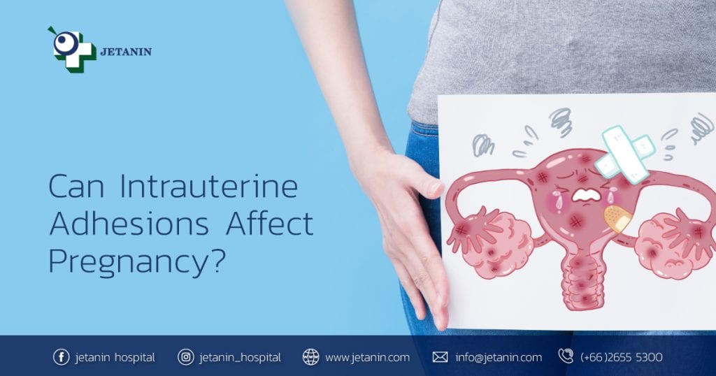 Can Intrauterine Adhesions Affect Pregnancy? | Jetanin